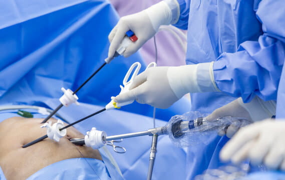 Laparoscopic Cholecystectomy being Performed